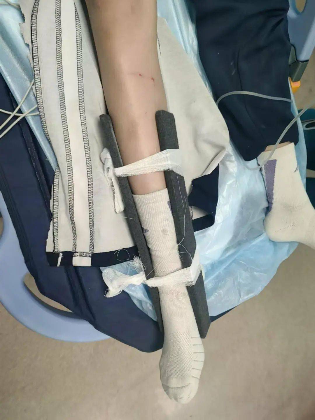 惨痛<strong></p>
<p>链币网</strong>！一人身亡！深圳多名学生骑电动车发生意外