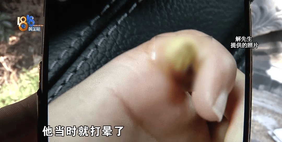 5岁男童瞬间晕厥<strong></p>
<p>wfee币</strong>，筋都断了！街上常见，看见立即远离