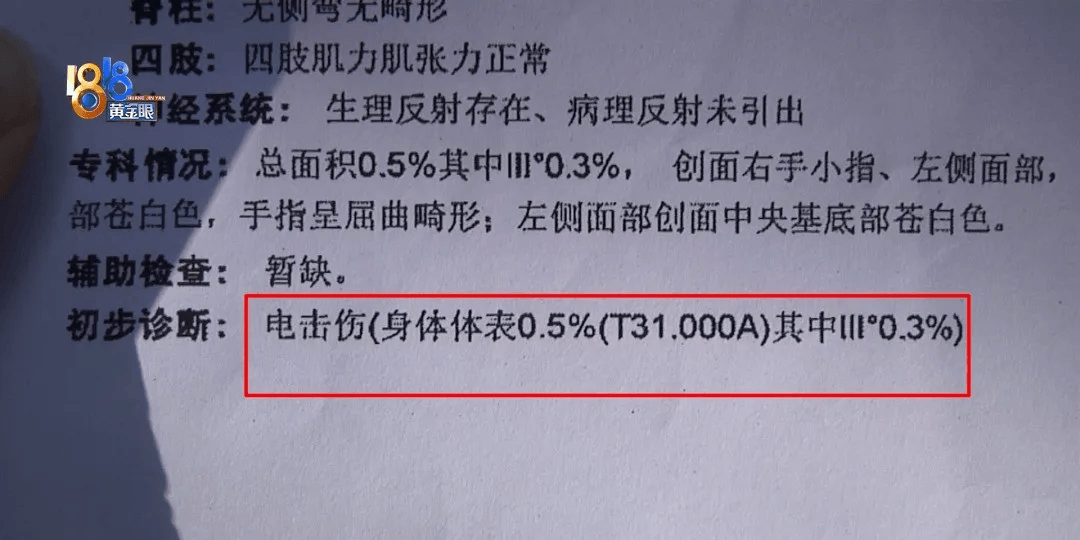 5岁男童瞬间晕厥<strong></p>
<p>wfee币</strong>，筋都断了！街上常见，看见立即远离