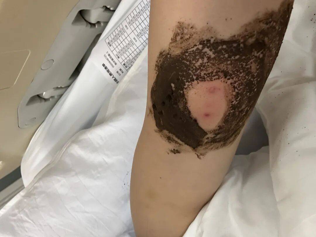 4名游客景区内遭马蜂袭击<strong></p>
<p>币圈信息</strong>，旅游度假区：是森林公园不卖门票，蜇伤先就医后提供证据投诉