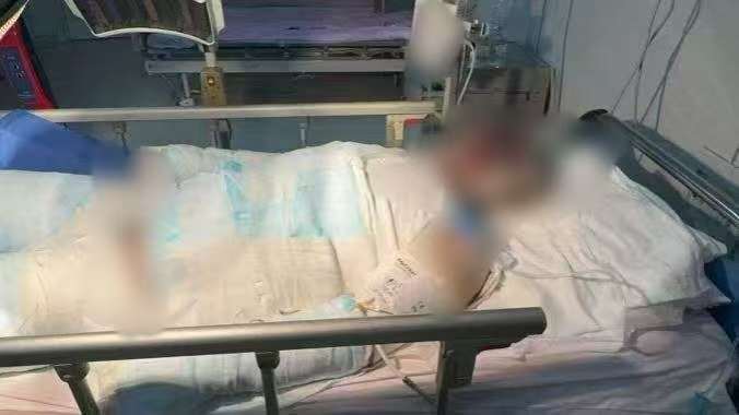 父子在哈尔滨一亲戚公司上班遇爆炸全身烧伤<strong></p>
<p>币圈信息</strong>，治疗花费近百万公司拒赔偿？亲戚回应