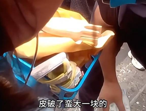看着都疼<strong></p>
<p>王莽币</strong>!上海街头一男子突然求助:10岁女儿被死死卡住!这个行为太危险→
