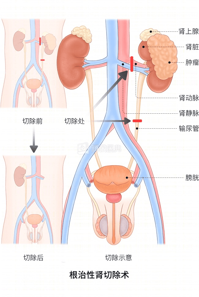 “感觉天塌了”！深圳女孩5岁患癌<strong></p>
<p>玩克币行情</strong>，爸妈决定：为她冻存卵巢组织